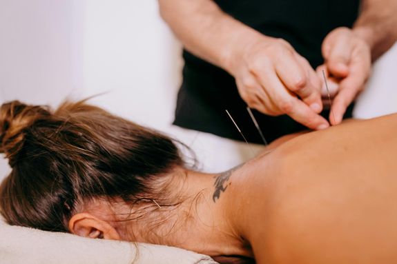Hands Inserting Needles on the Person's Back 