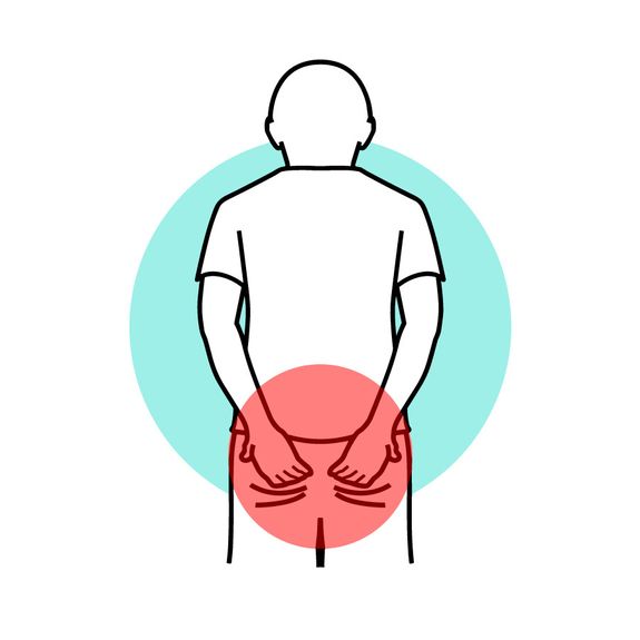 Sciatica