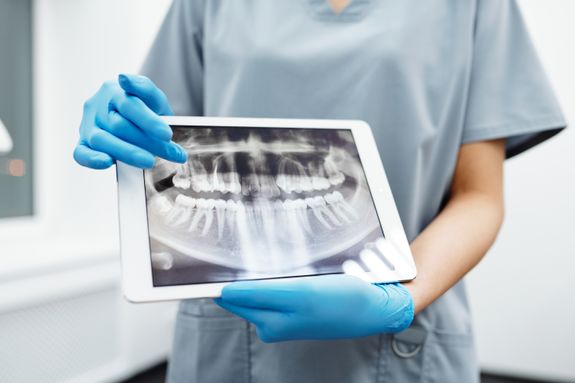 Person Holding White Tablet Computer with Picture of Teeth