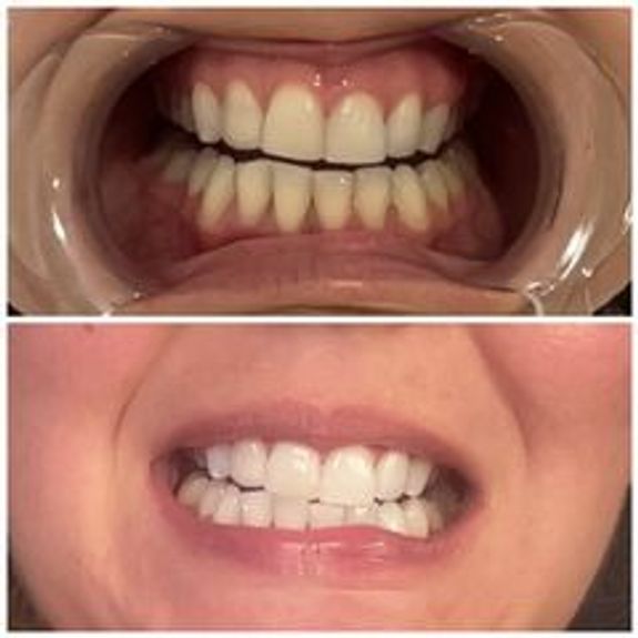 Limited Time Offers to Save Big