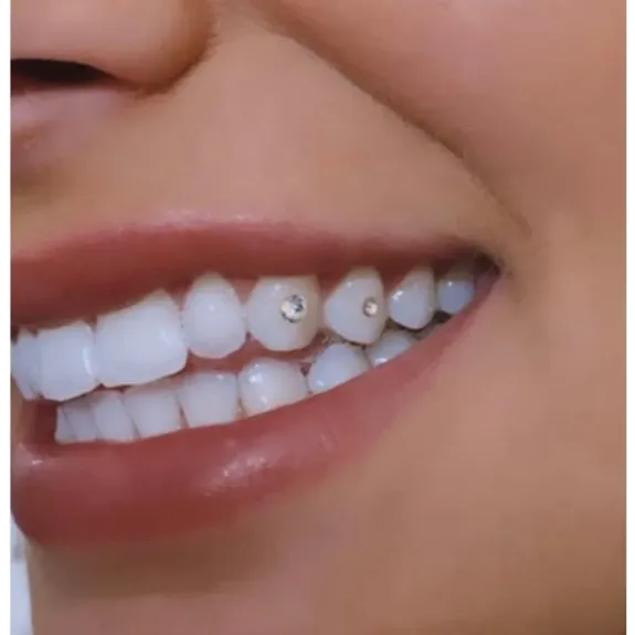 Transform Your Smile with Expert Care in North Lakes, Brisbane