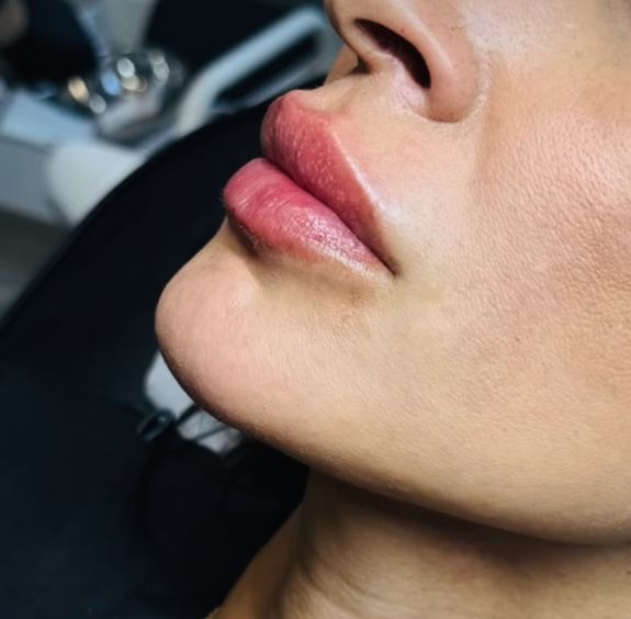 Elevate Your Beauty Experience with Aesthetics by Sara Alves