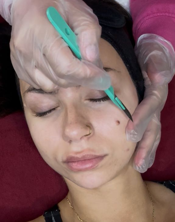 Relaxation Remedy Signuature Dermaplane For Her