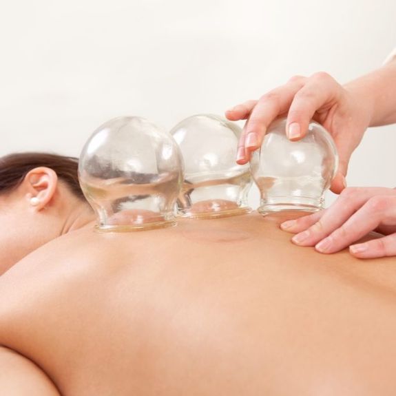 Cupping